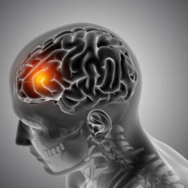 merkzeichen ag bei neurologischen erkrankungen